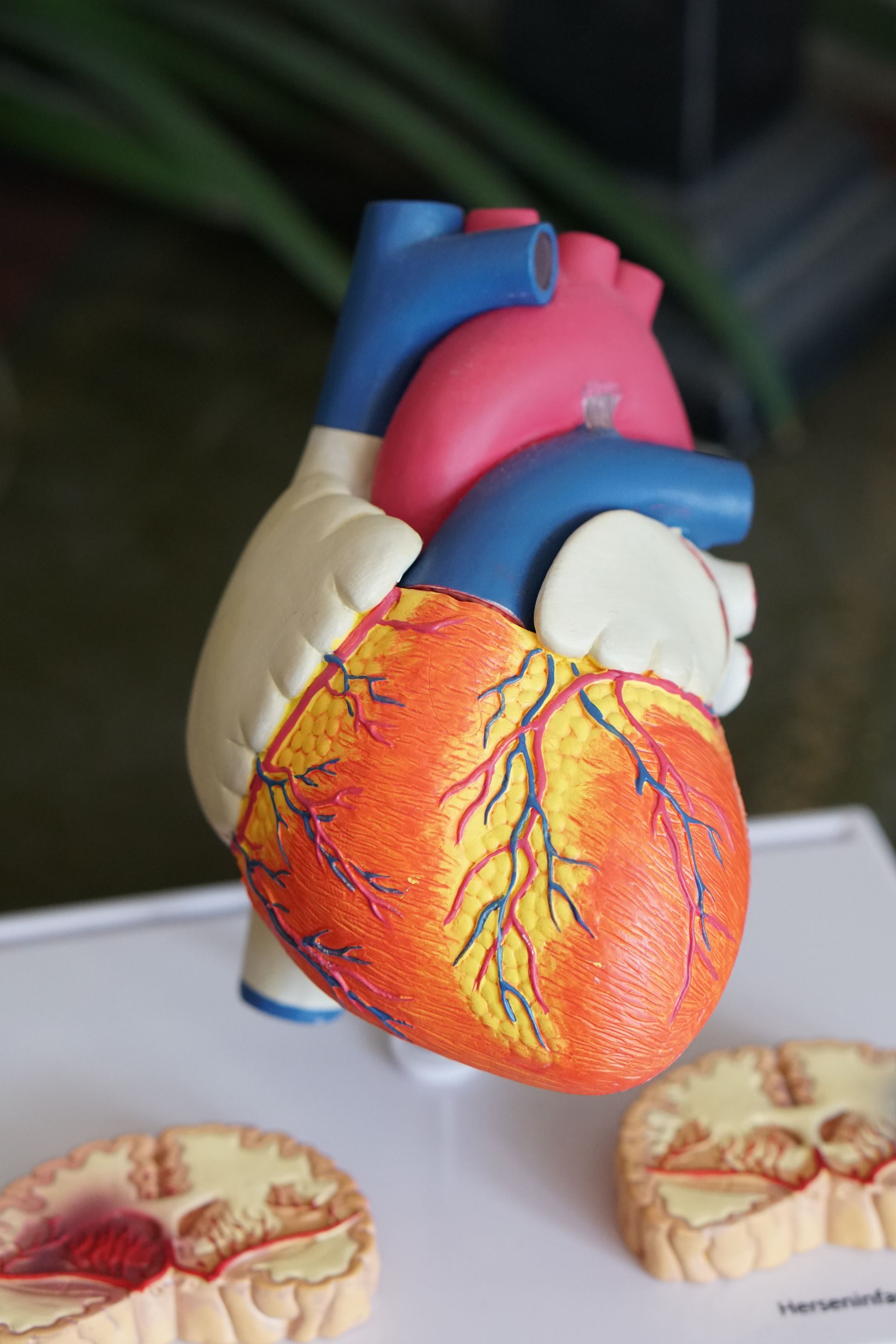 heart 1